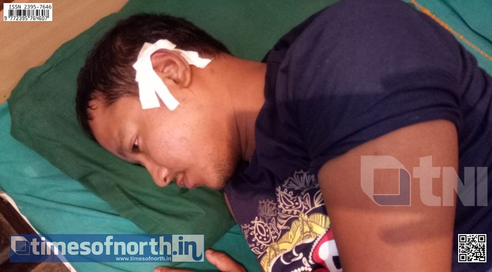 Civic Volunteer Attacked in an Anti Liquor Drive at Dhupguri
